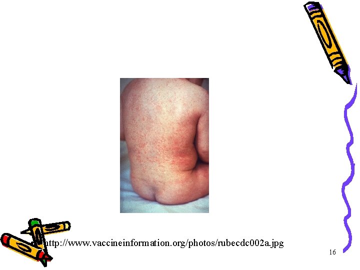 • http: //www. vaccineinformation. org/photos/rubecdc 002 a. jpg 16 • http: //www. vaccineinformation. org/photos/rubecdc 002 a. jpg 16