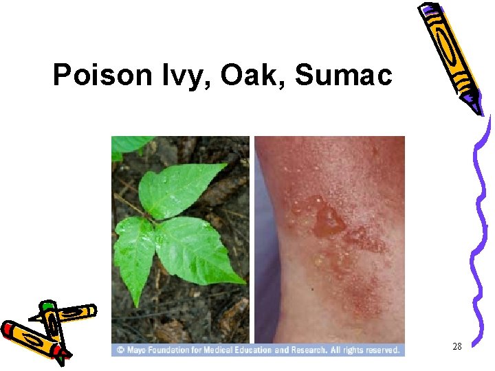Poison Ivy, Oak, Sumac 28 Poison Ivy, Oak, Sumac 28