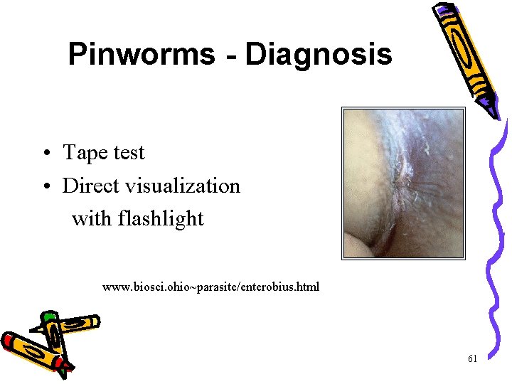Pinworms - Diagnosis • Tape test • Direct visualization with flashlight www. biosci. ohio~parasite/enterobius. Pinworms - Diagnosis • Tape test • Direct visualization with flashlight www. biosci. ohio~parasite/enterobius.