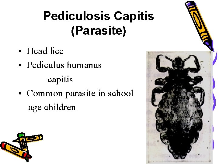 Pediculosis Capitis (Parasite) • Head lice • Pediculus humanus capitis • Common parasite in Pediculosis Capitis (Parasite) • Head lice • Pediculus humanus capitis • Common parasite in