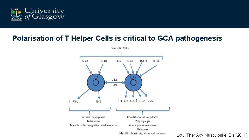 Polarisation of T Helper Cells is critical to GCA pathogenesis Low, Ther Adv Musculoskel