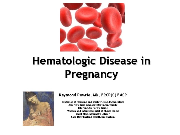 Hematologic Disease in Pregnancy Raymond Powrie, MD, FRCP(C) FACP Professor of Medicine and Obstetrics