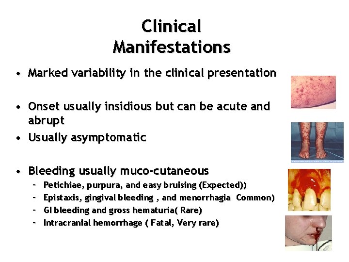 Clinical Manifestations • Marked variability in the clinical presentation • Onset usually insidious but
