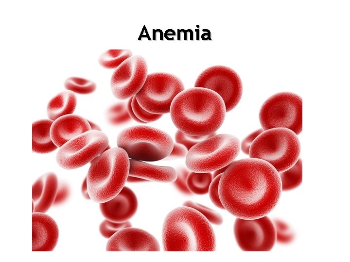 Anemia 