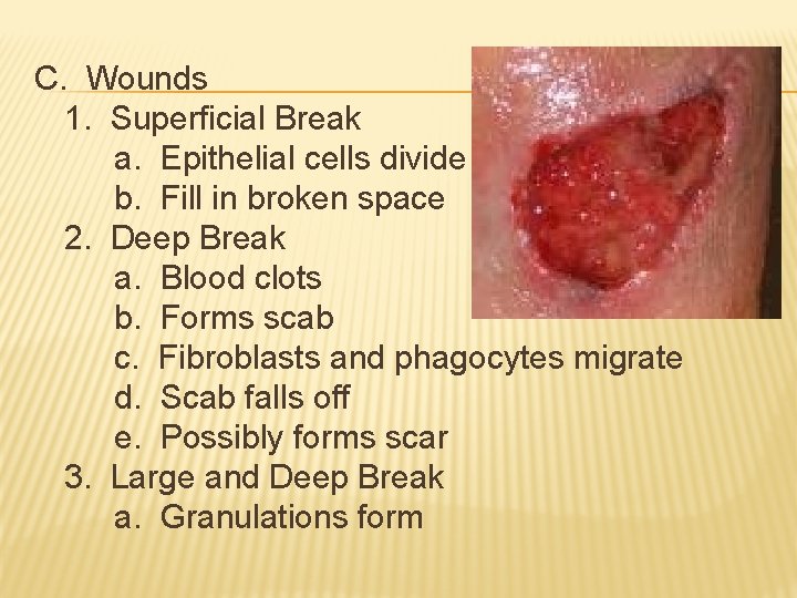 C. Wounds 1. Superficial Break a. Epithelial cells divide b. Fill in broken space C. Wounds 1. Superficial Break a. Epithelial cells divide b. Fill in broken space