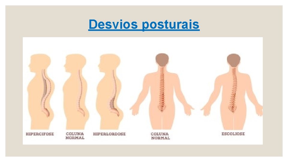  Desvios posturais 