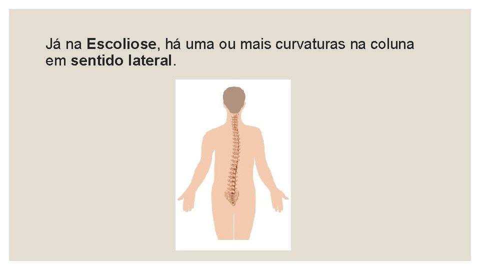  Já na Escoliose, há uma ou mais curvaturas na coluna em sentido lateral.