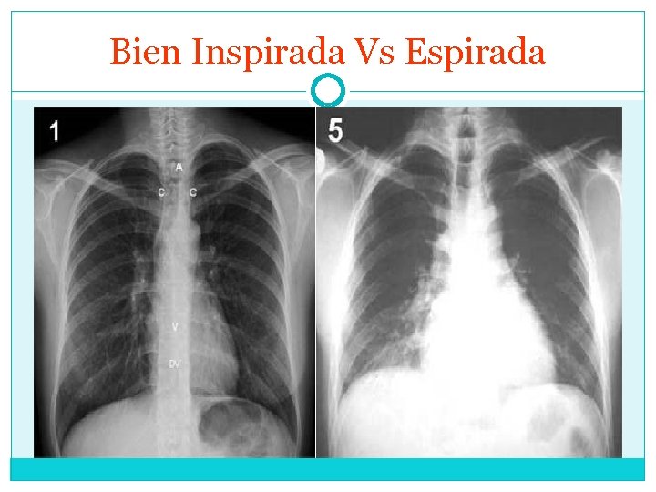 Bien Inspirada Vs Espirada 