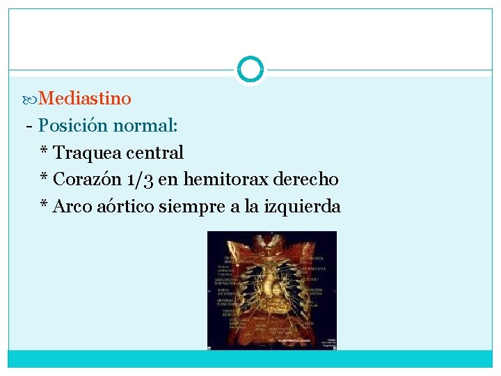  Mediastino - Posición normal: * Traquea central * Corazón 1/3 en hemitorax derecho