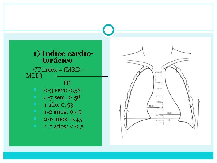 1) Indice cardiotorácico CT index = (MRD + MLD) ID § 0 -3 sem:
