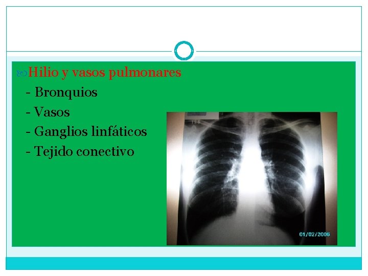  Hilio y vasos pulmonares - Bronquios - Vasos - Ganglios linfáticos - Tejido