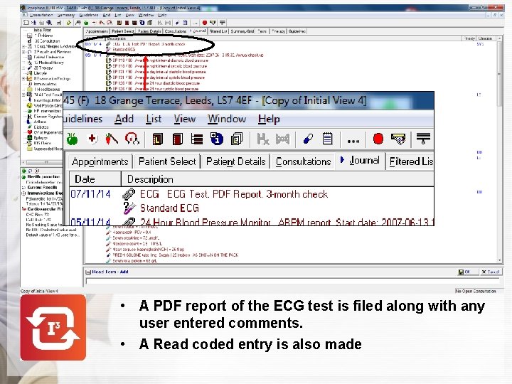  • A PDF report of the ECG test is filed along with any