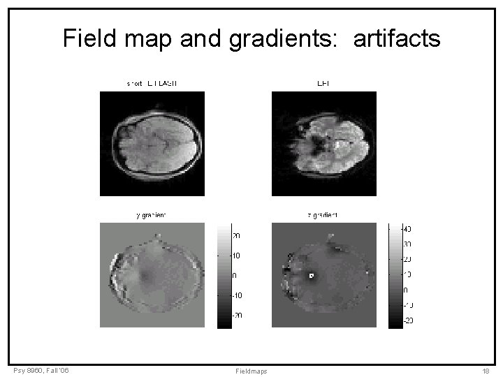 Field map and gradients: artifacts Psy 8960, Fall ‘ 06 Fieldmaps 18 