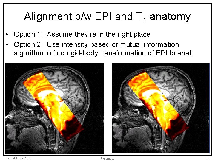 Alignment b/w EPI and T 1 anatomy • Option 1: Assume they’re in the