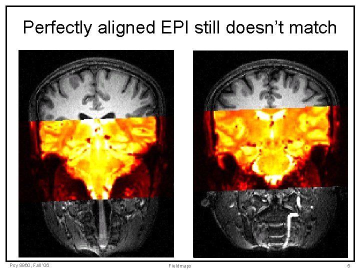 Perfectly aligned EPI still doesn’t match Psy 8960, Fall ‘ 06 Fieldmaps 5 