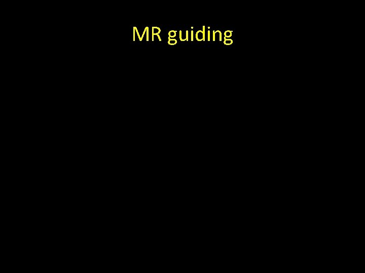 MR guiding MR guiding