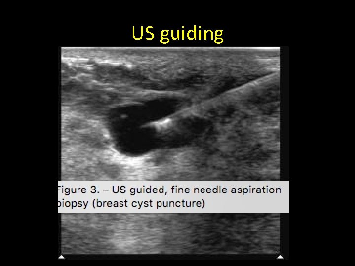 US guiding US guiding