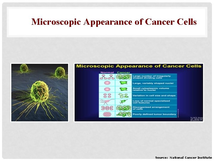 Microscopic Appearance of Cancer Cells Source: National Cancer Institute 