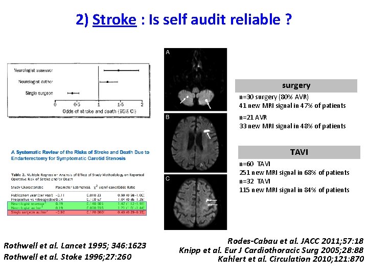 2) Stroke : Is self audit reliable ? surgery n=30 surgery (80% AVR) 41
