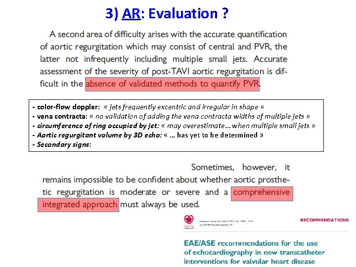 3) AR: Evaluation ? - color-flow doppler: « jets frequently excentric and irregular in