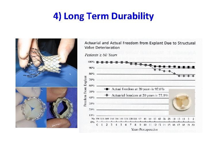 4) Long Term Durability 