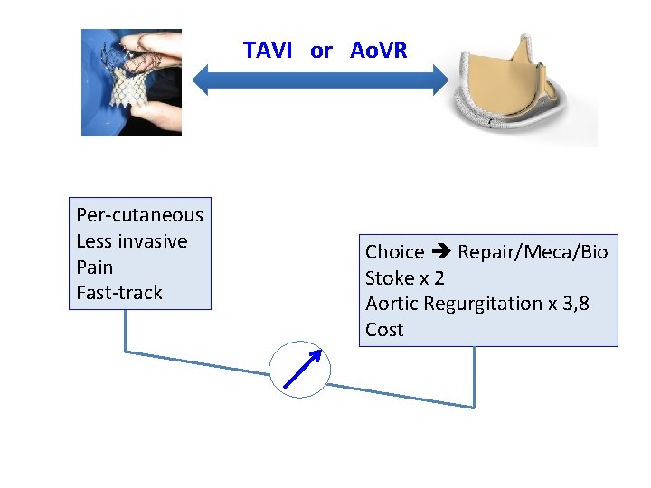 TAVI or Ao. VR Per-cutaneous Less invasive Pain Fast-track Choice Repair/Meca/Bio Stoke x 2