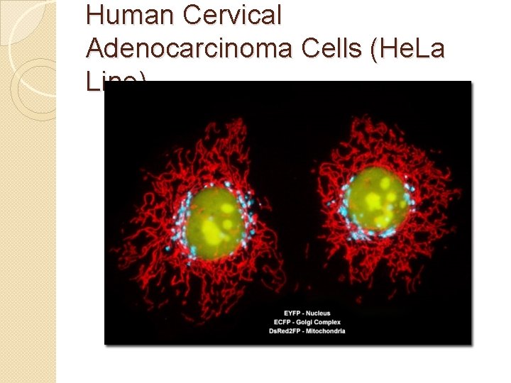 Human Cervical Adenocarcinoma Cells (He. La Line) 