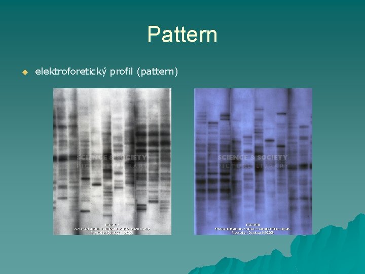 Pattern u elektroforetický profil (pattern) 