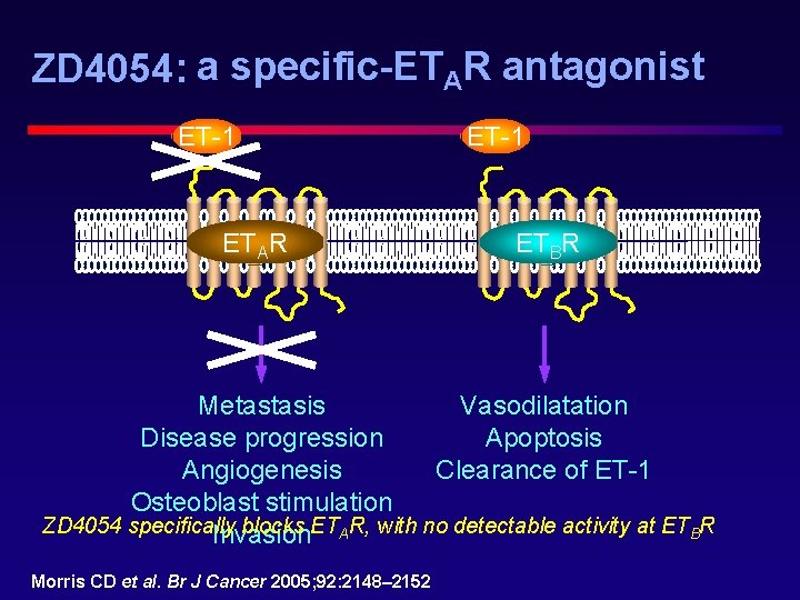 ZD 4054: a specific-ETAR antagonist ET-1 ETAR ET-1 ETBR Vasodilatation Metastasis Apoptosis Disease progression