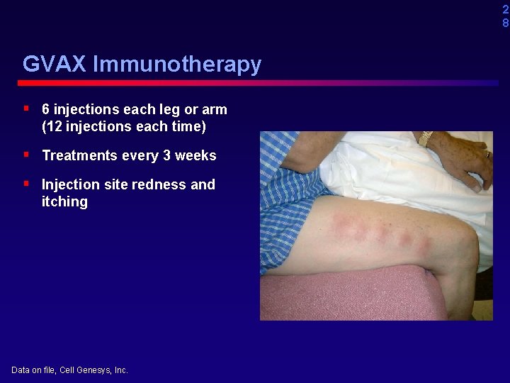 2 8 GVAX Immunotherapy § 6 injections each leg or arm (12 injections each