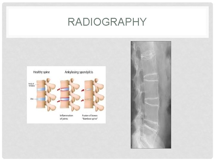 RADIOGRAPHY 