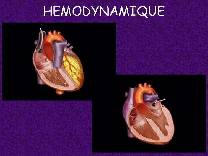 HEMODYNAMIQUE 