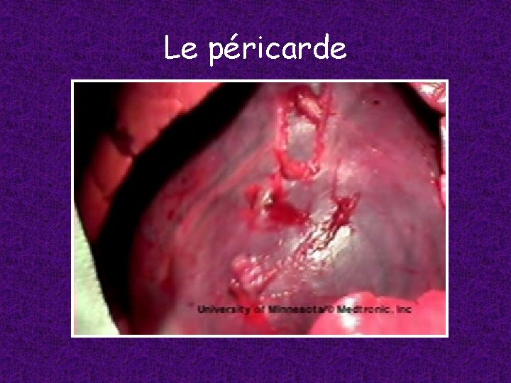 Le péricarde 