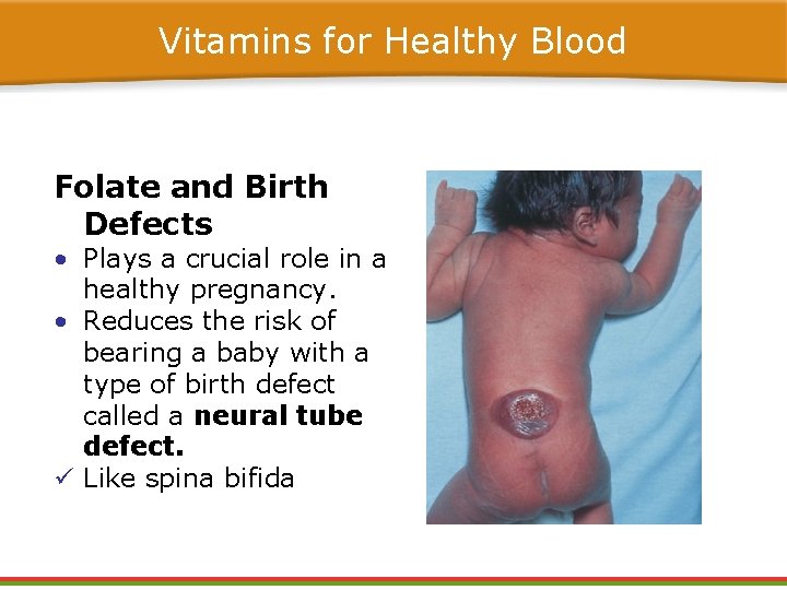 Vitamins for Healthy Blood Folate and Birth Defects • Plays a crucial role in Vitamins for Healthy Blood Folate and Birth Defects • Plays a crucial role in