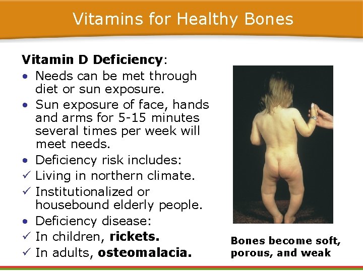 Vitamins for Healthy Bones Vitamin D Deficiency: • Needs can be met through diet Vitamins for Healthy Bones Vitamin D Deficiency: • Needs can be met through diet