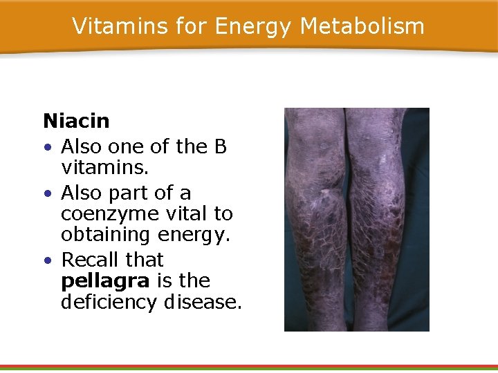 Vitamins for Energy Metabolism Niacin • Also one of the B vitamins. • Also Vitamins for Energy Metabolism Niacin • Also one of the B vitamins. • Also