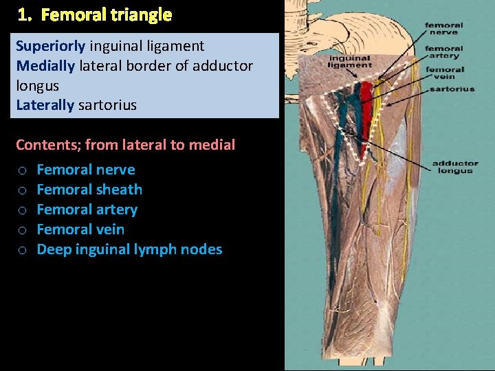 1. Femoral triangle Superiorly inguinal ligament Medially lateral border of adductor longus Laterally sartorius 1. Femoral triangle Superiorly inguinal ligament Medially lateral border of adductor longus Laterally sartorius