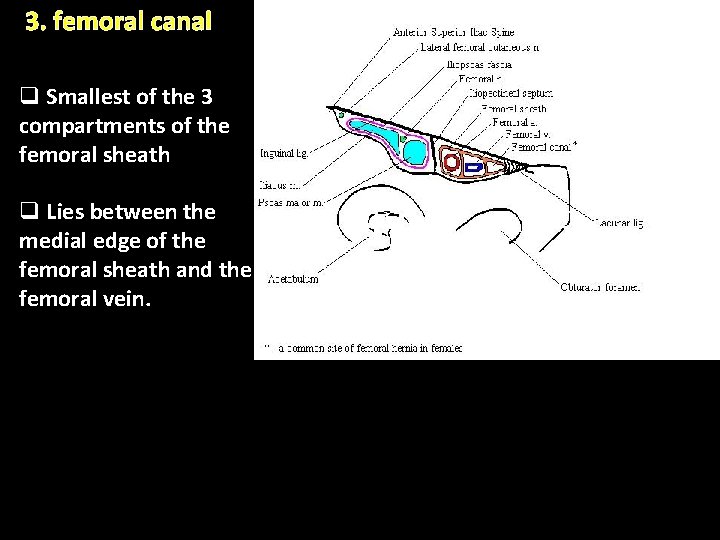 3. femoral canal q Smallest of the 3 compartments of the femoral sheath q 3. femoral canal q Smallest of the 3 compartments of the femoral sheath q
