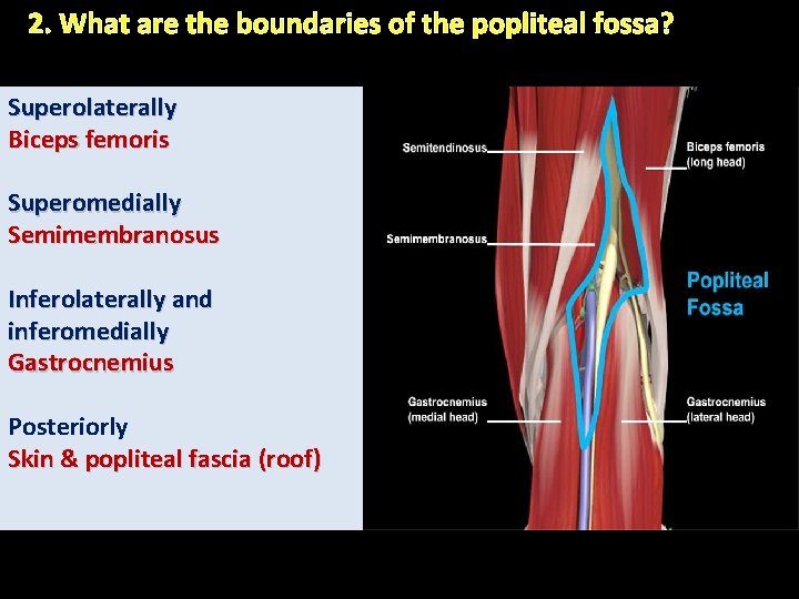 2. What are the boundaries of the popliteal fossa? Superolaterally Biceps femoris Superomedially Semimembranosus 2. What are the boundaries of the popliteal fossa? Superolaterally Biceps femoris Superomedially Semimembranosus