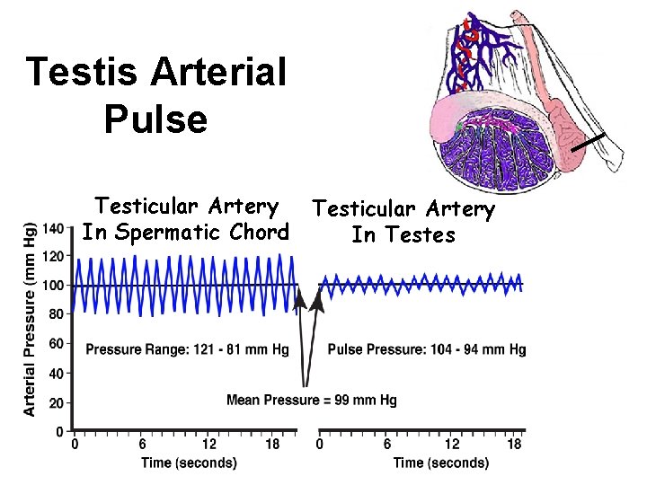 Testis Arterial Pulse Testicular Artery In Spermatic Chord Testicular Artery In Testes 
