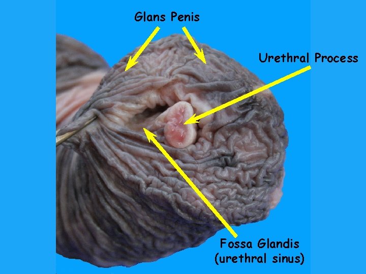 Glans Penis Urethral Process Fossa Glandis (urethral sinus) 