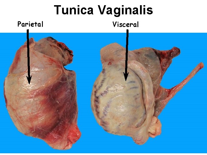 Tunica Vaginalis Parietal Visceral 