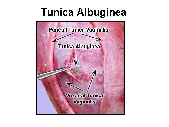 Tunica Albuginea 