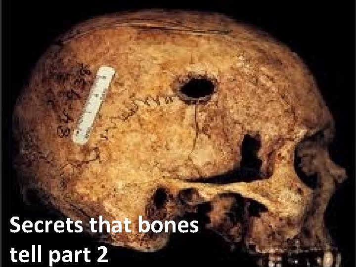 Secrets that bones tell part 2 