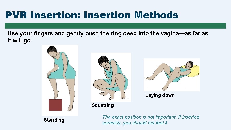 PVR Insertion: Insertion Methods Use your fingers and gently push the ring deep into