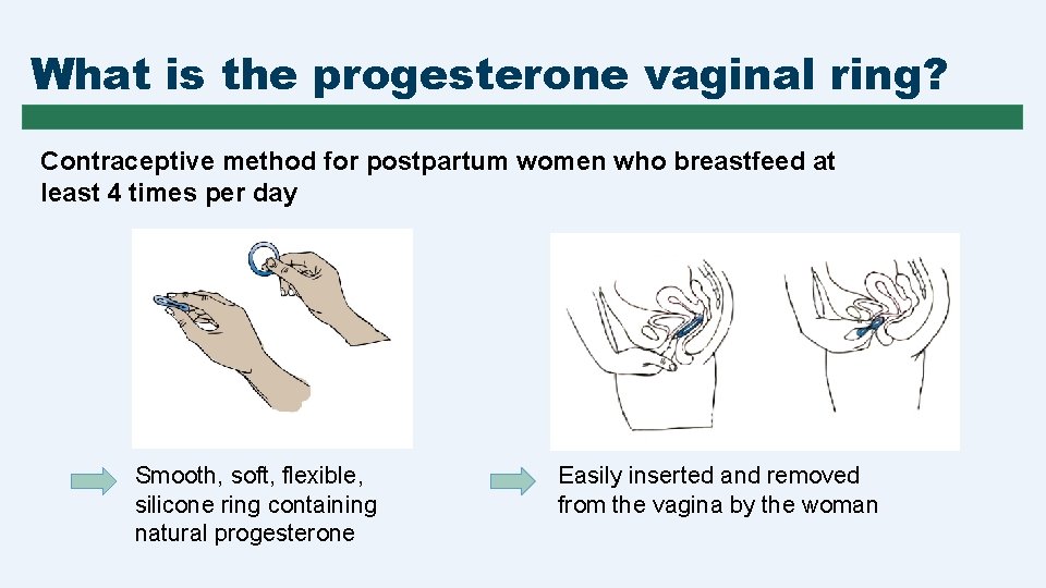 What is the progesterone vaginal ring? Contraceptive method for postpartum women who breastfeed at