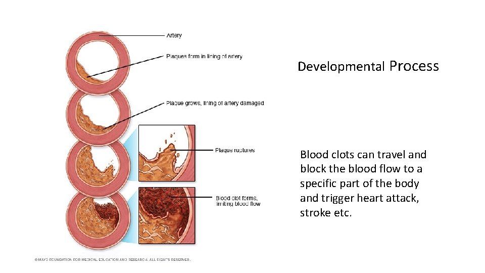 Developmental Process Blood clots can travel and block the blood flow to a specific