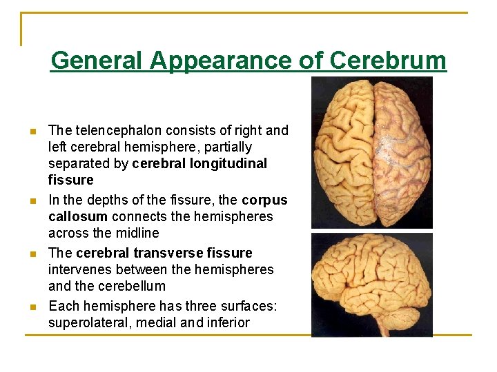 General Appearance of Cerebrum n n The telencephalon consists of right and left cerebral