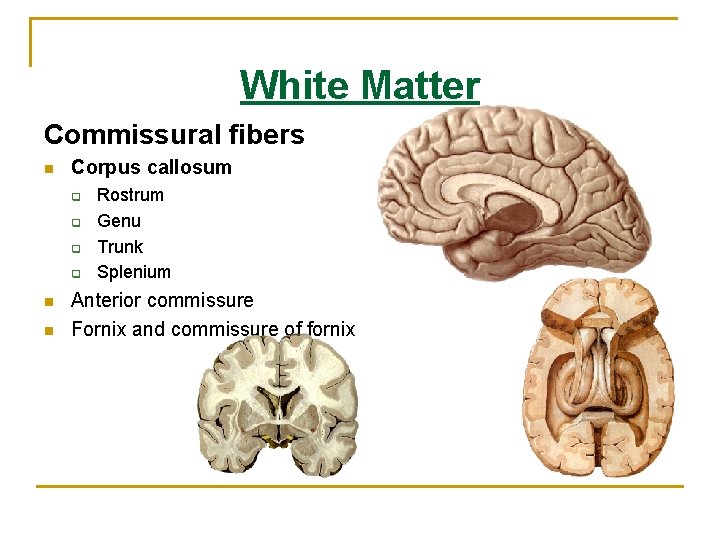 White Matter Commissural fibers n Corpus callosum q q n n Rostrum Genu Trunk