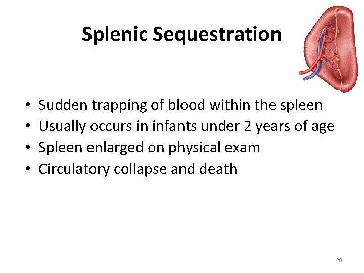 Splenic Sequestration • • Sudden trapping of blood within the spleen Usually occurs in